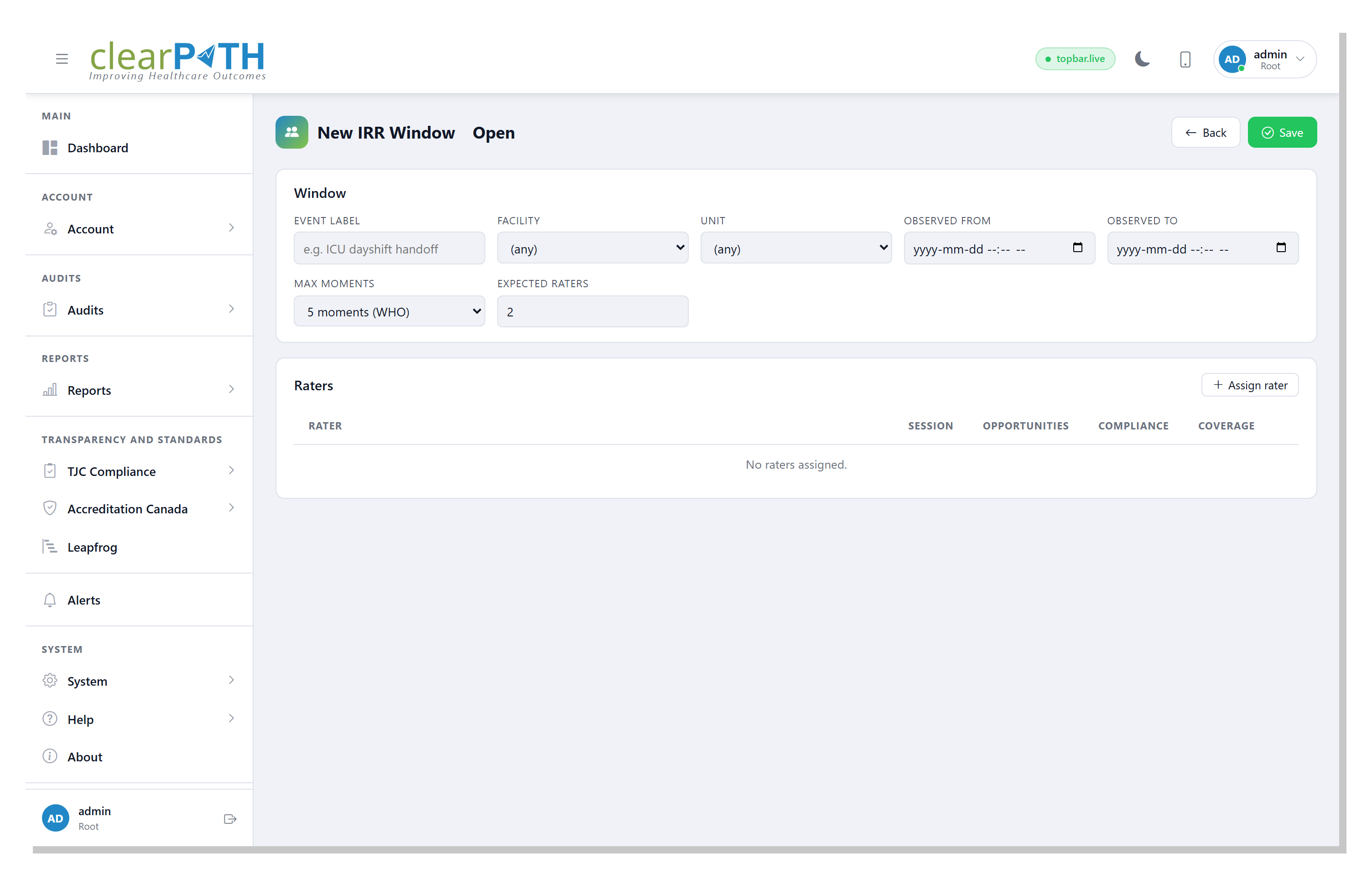 IRR window editor with rate-agreement card